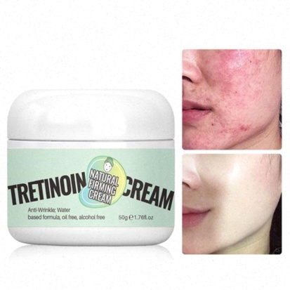 tretinoina crema